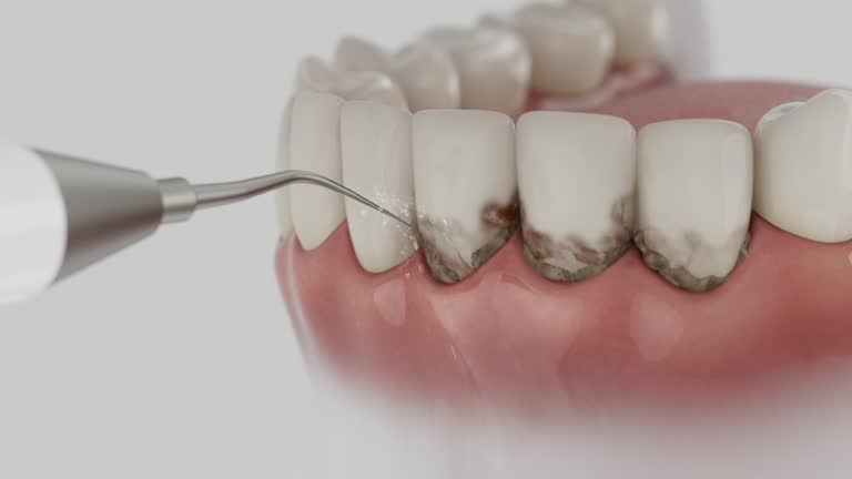 Reliable Dental contractor in Dahlgren, VA by Smile Center Dentistry